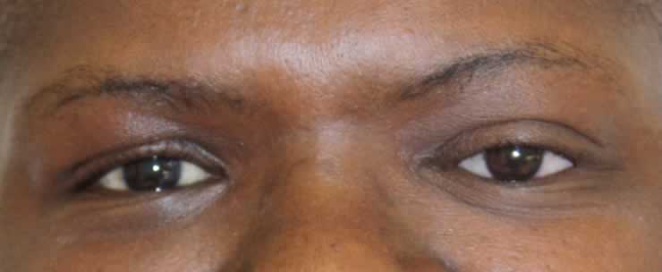 I Lost my Eye - Eyes Alive